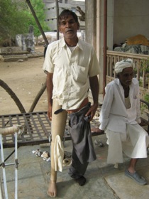 StandingtallwithhisJaipurfoot
