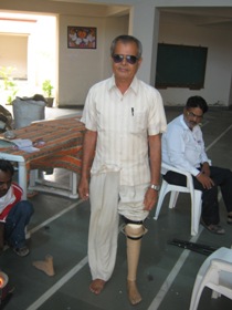 StandingtallwithhisJaipurfoot