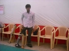 StandingtallwithhisJaipurfoot