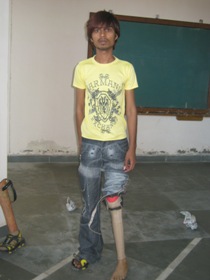 StandingtallwithhisJaipurfoot