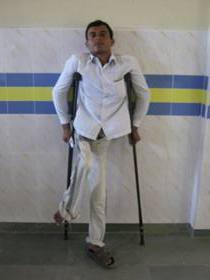 Disabledpersonwithcrutches