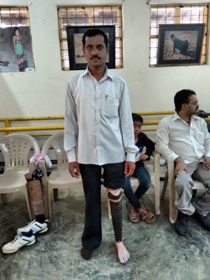 StandingtallwithhisJaipurfoot